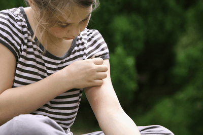 Best Antihistamines for Bug and Insect Bites